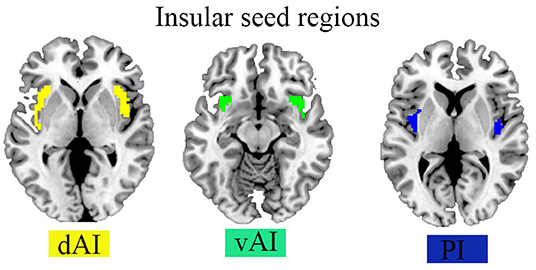 Just thinking about doing a math problem causes some people's posterior  insula—the part of the brain that reacts when you're physically…