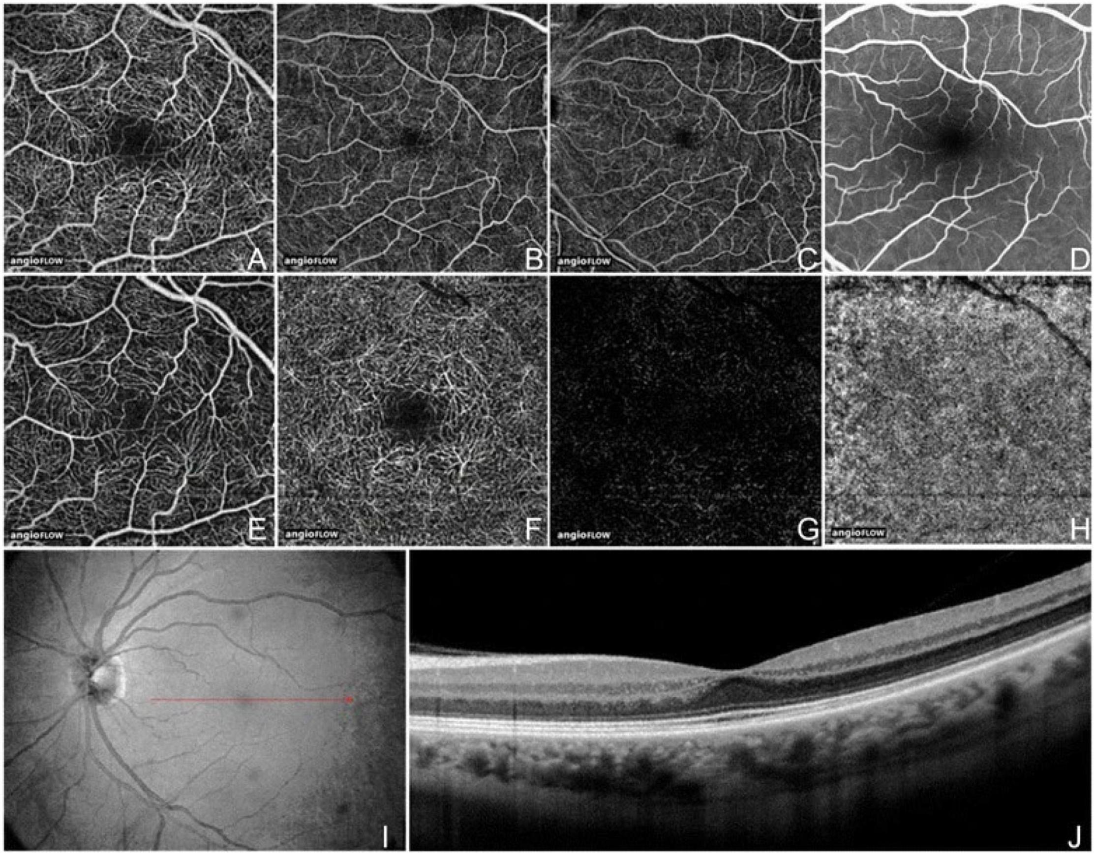 AO Scan: The Revolutionary Early Detection System of Disease Using