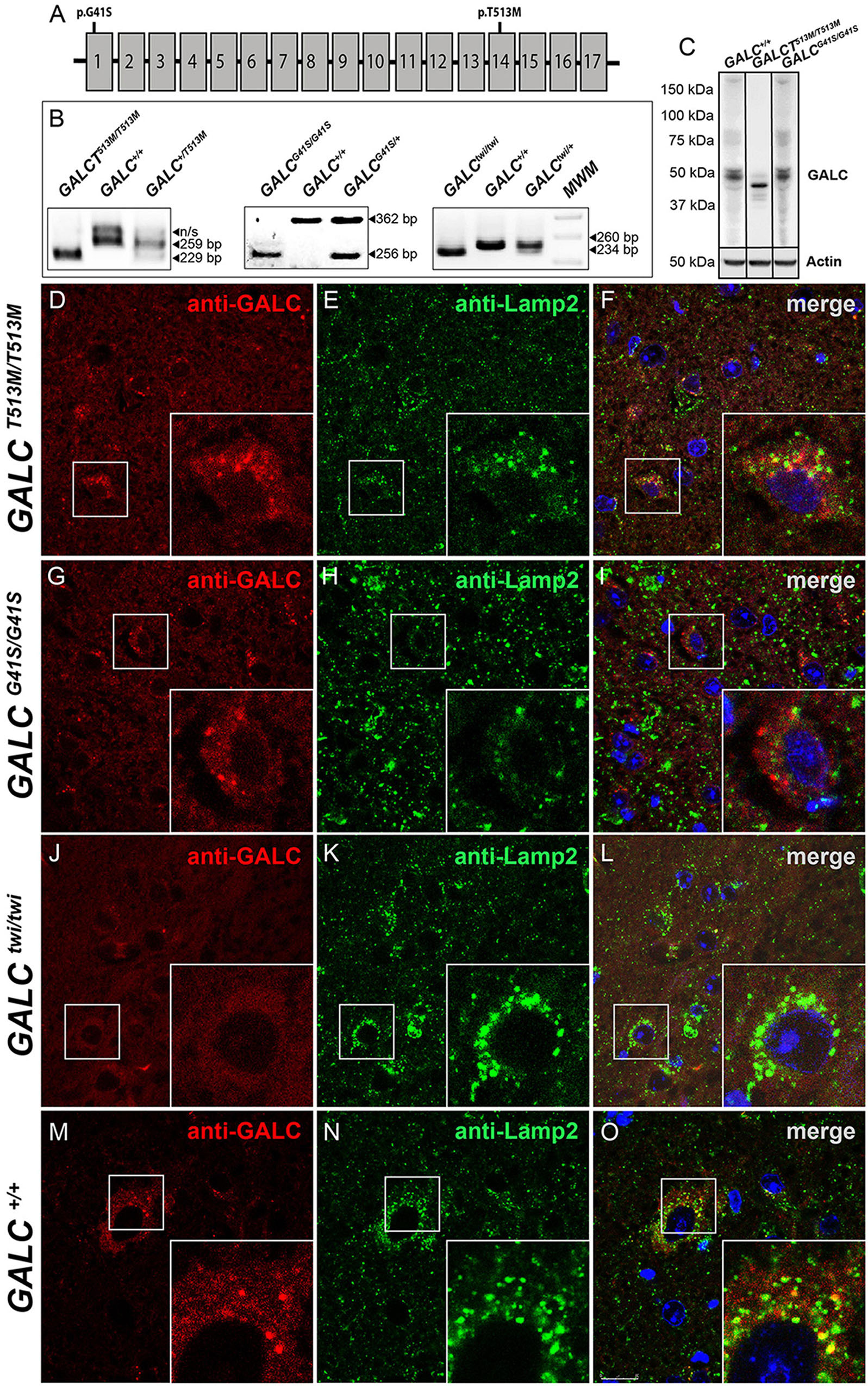 Frontiers  Lysosomal Diseases and Neuropsychiatry: Opportunities