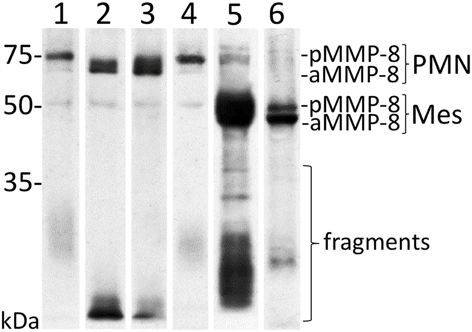 Frontiers   aMMP Oral Fluid PoC Test in Relation to Oral and