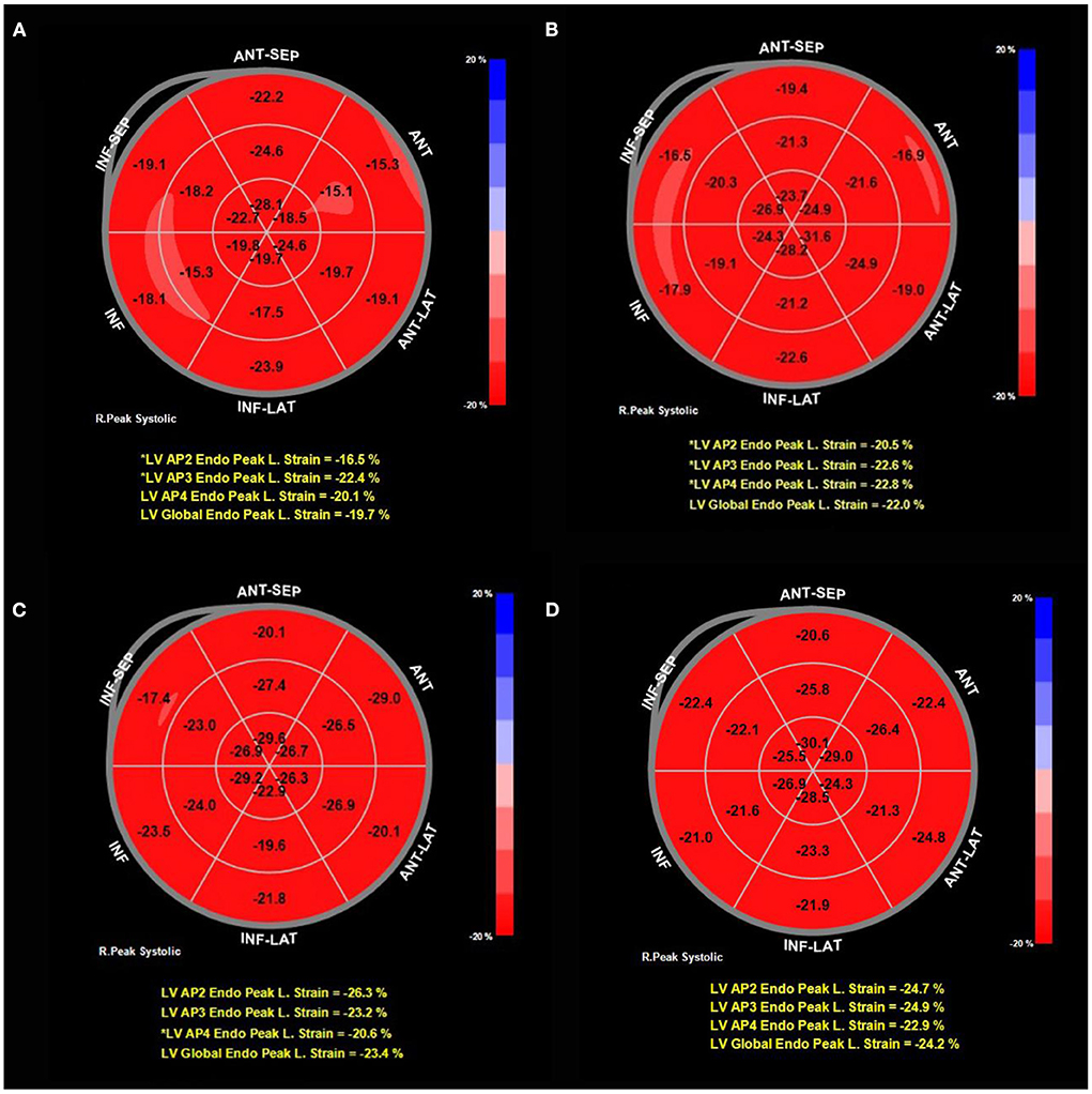 Speckle tracking derived strain in neonates: planes, layers and