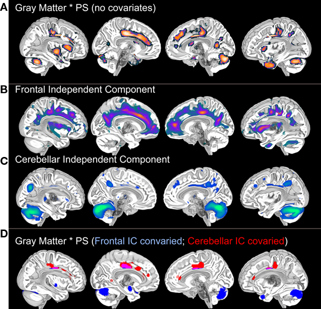 Brain processing