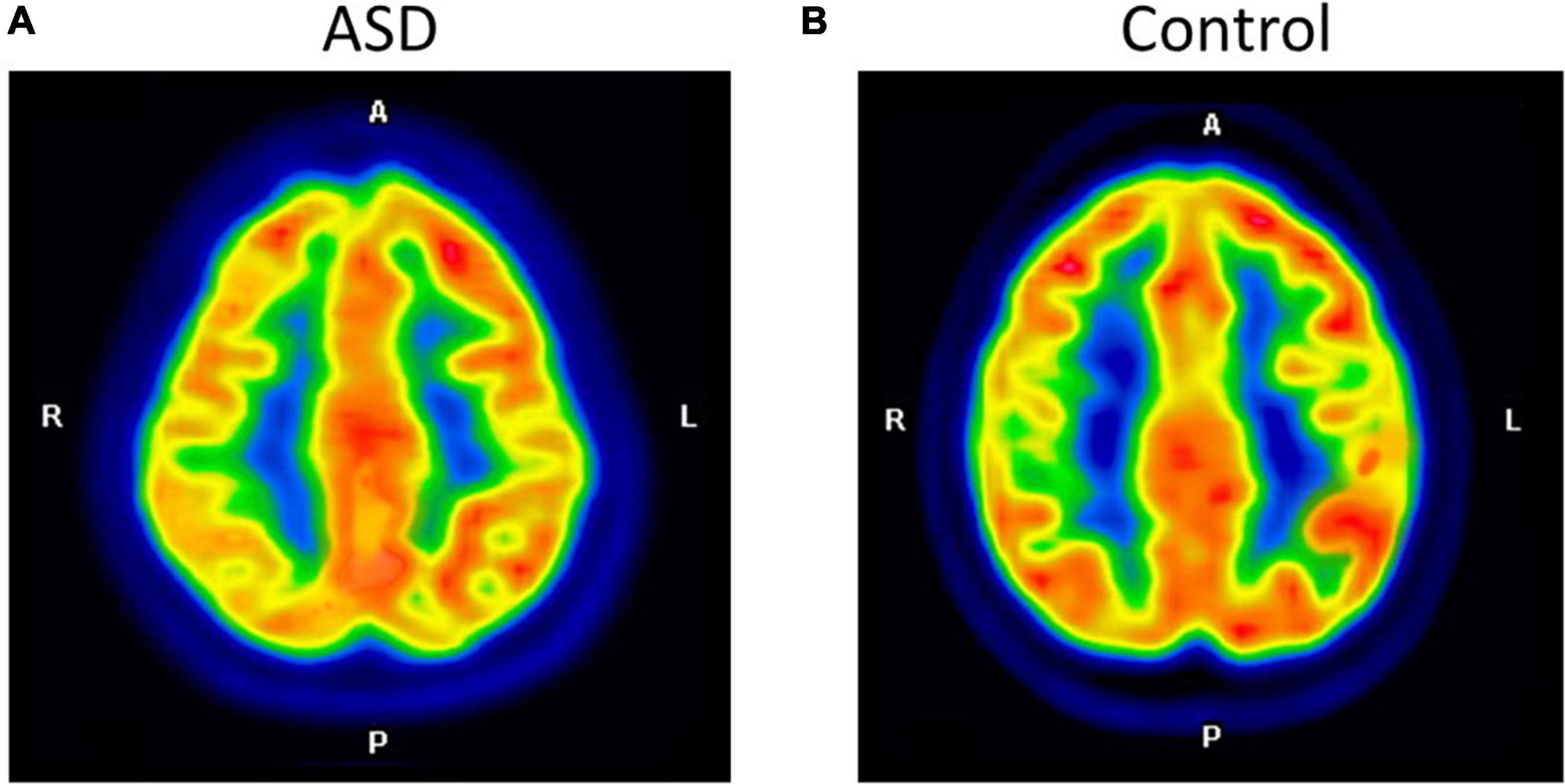 The test database of MR brain images and corresponding results for the