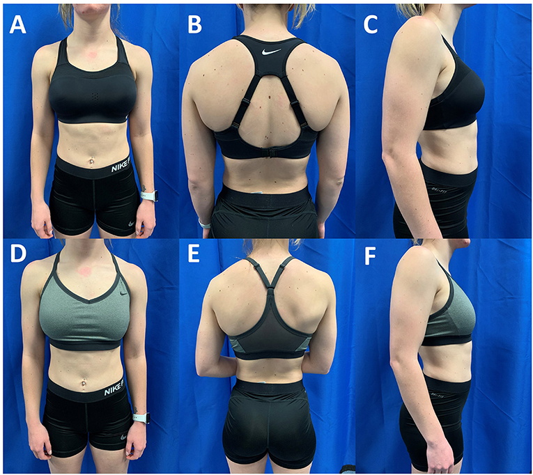 Frontiers  Greater Breast Support Is Associated With Reduced Oxygen  Consumption and Greater Running Economy During a Treadmill Running Task