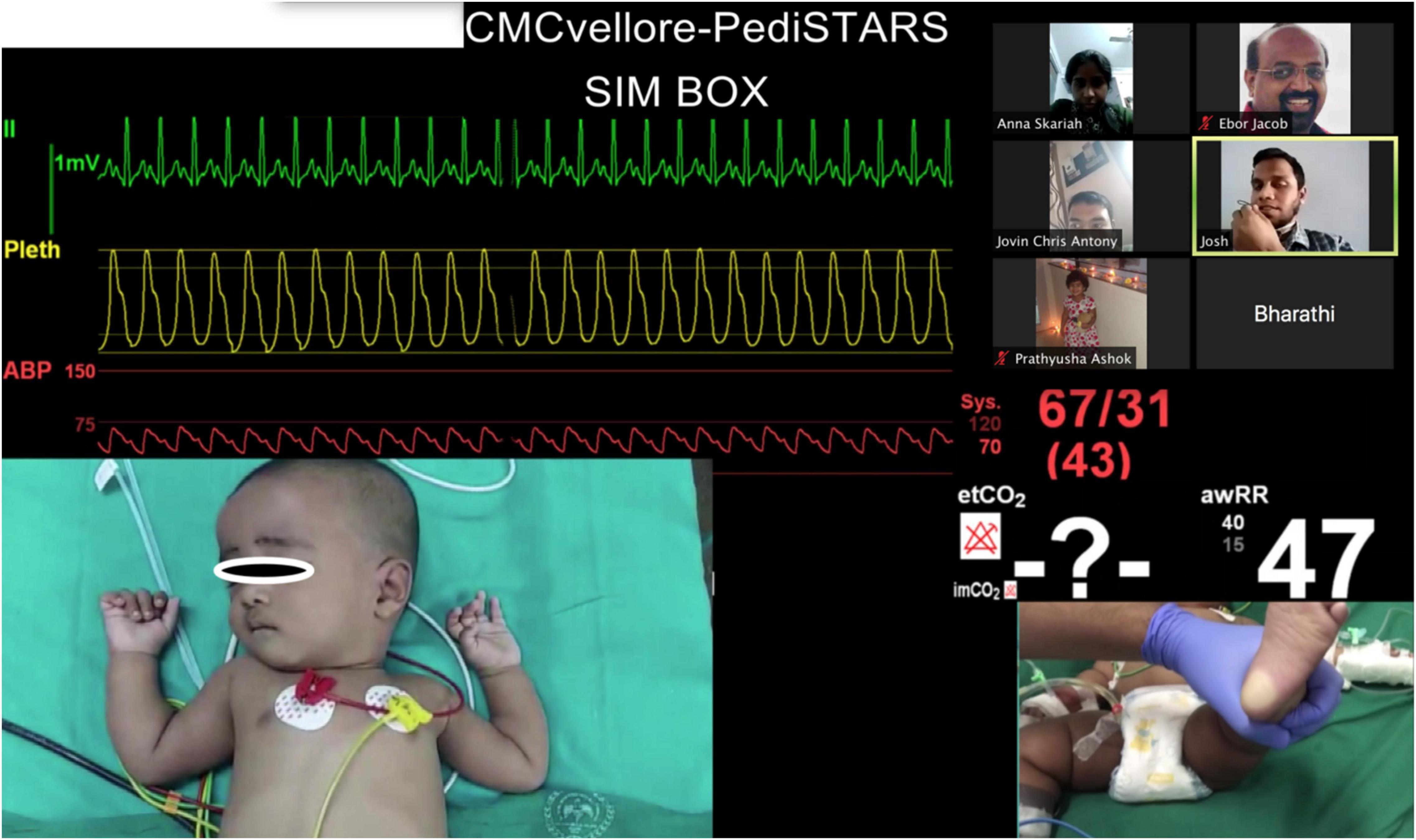 Frontiers  Effects of Blindfold on Leadership in Pediatric Resuscitation  Simulation: A Randomized Trial