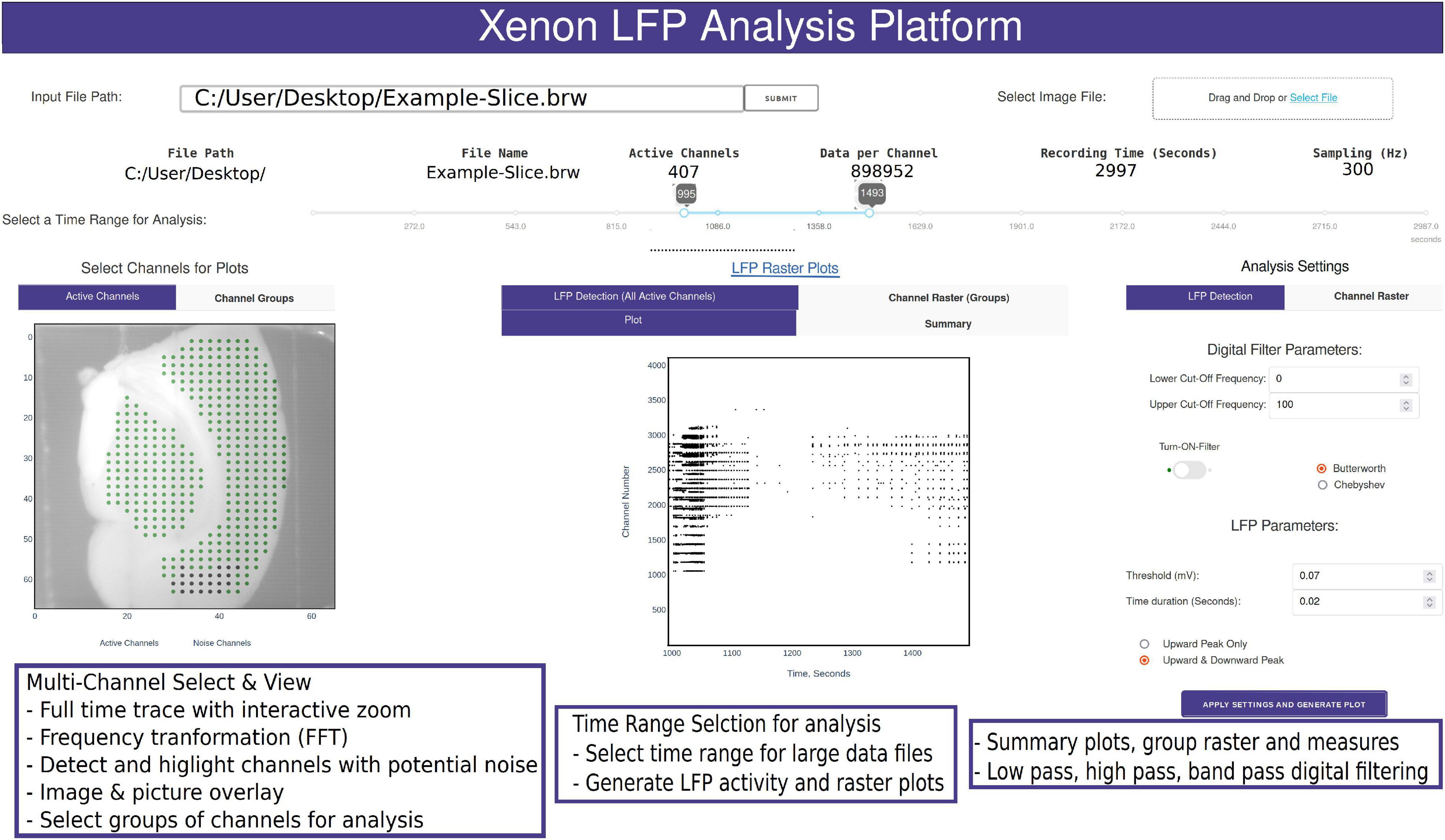 Xenon LFP Analysis Platform Is a Novel Graphical User Interface for Analysis of Local Field Potential From Large-Scale MEA Recordings