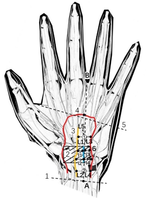PDF) Topographic Description of Metacarpal Tendons and Ligaments of Anatoly  Donkey by Ultrasonography and Introducing a New Ligament