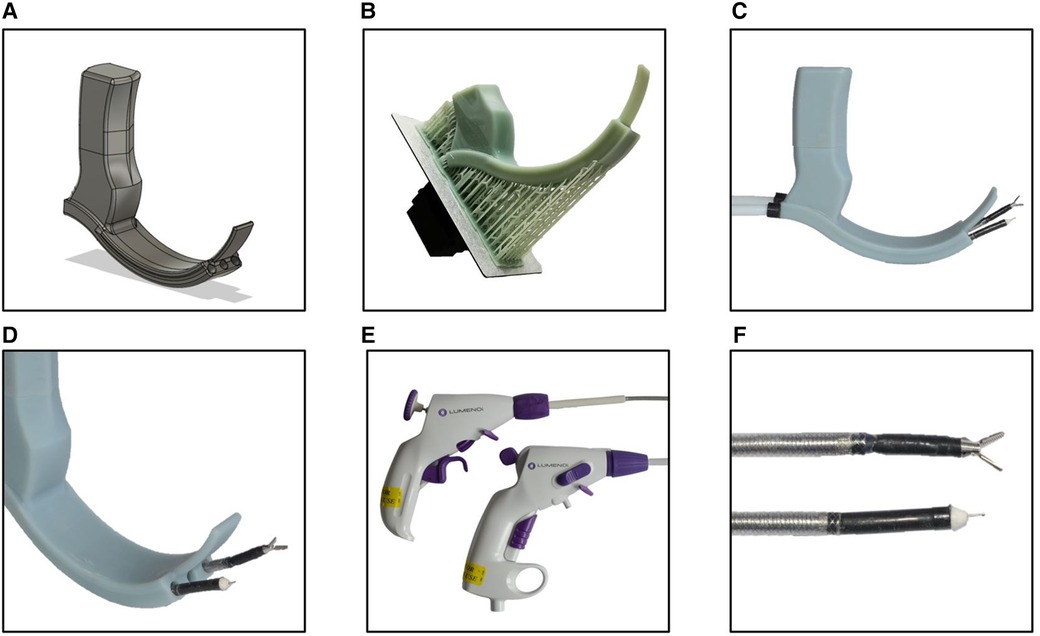 The Laryngoscope: Vol 130, No 6