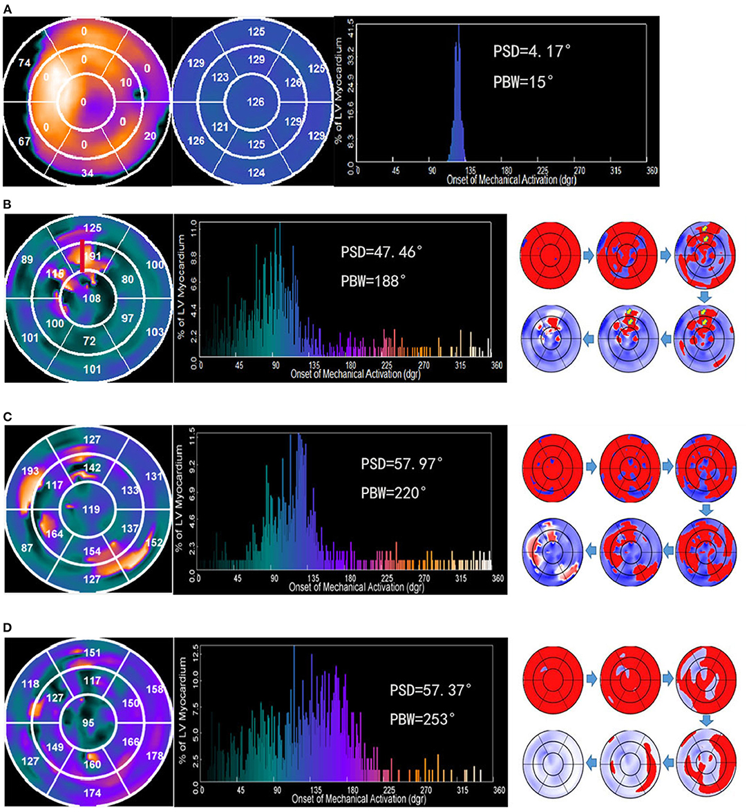 Andrew R. Houghton: Echo assessment of LV diastolic function