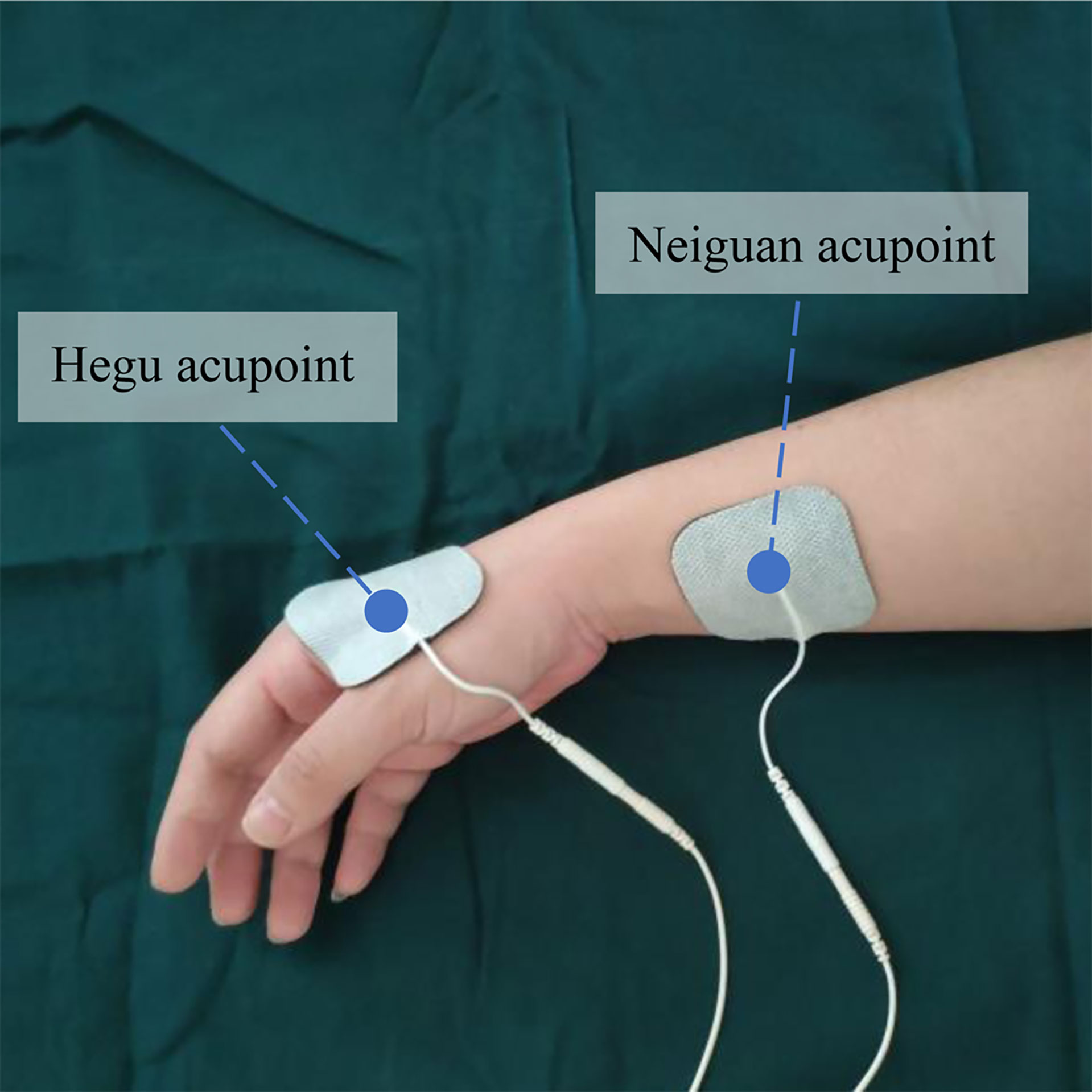 Blood Pressure Machine Upper Arm, 2 Size Cuffs M/L & XL, Medium/Large  9-17 & E