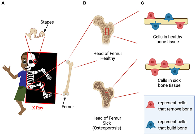 Figure 1 - (A) The bones of the skeleton can be visualized using X-rays.