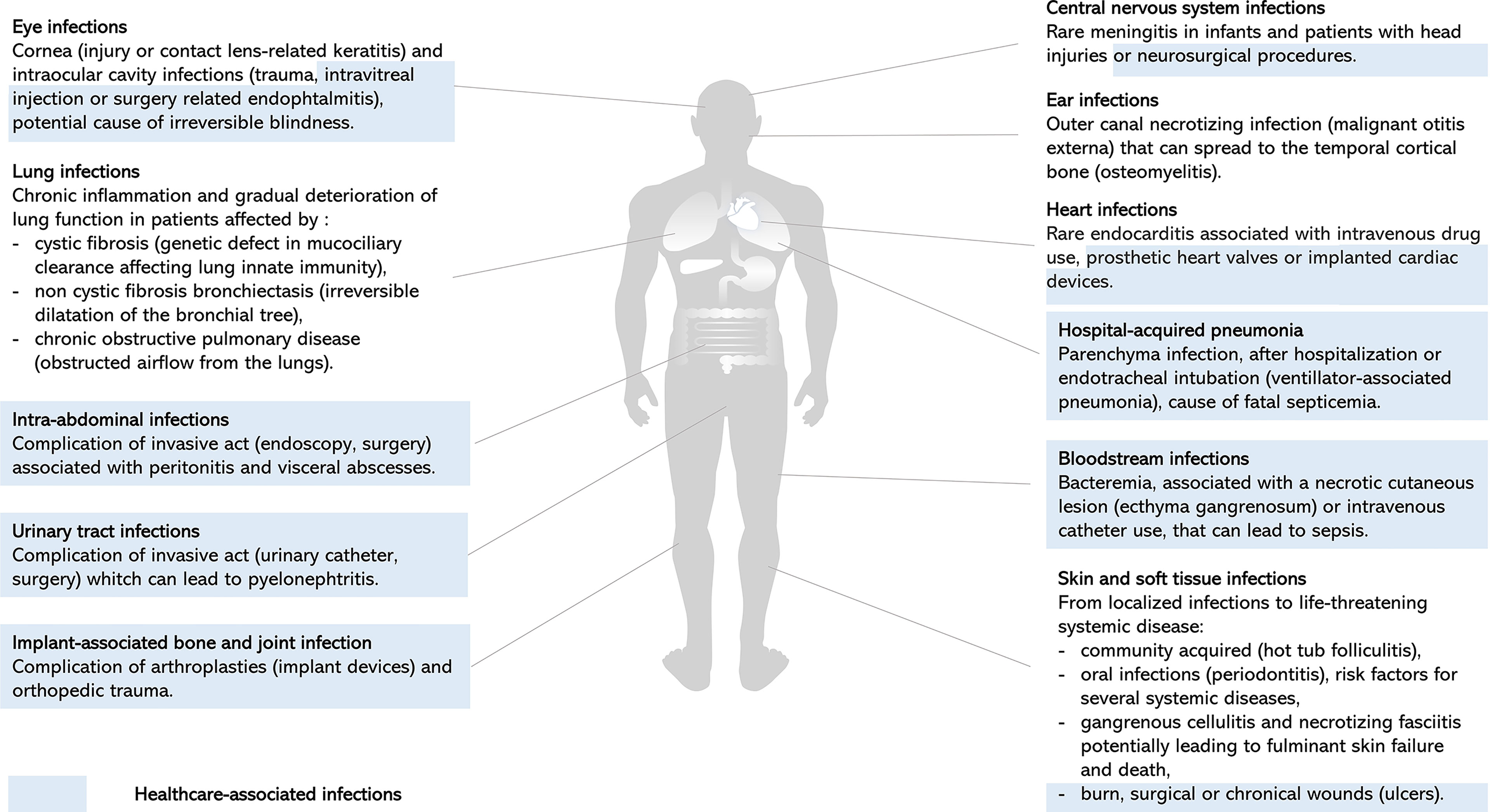 A Staph Vaccine Trial Failure Shows Challenges of Stopping Common Bugs