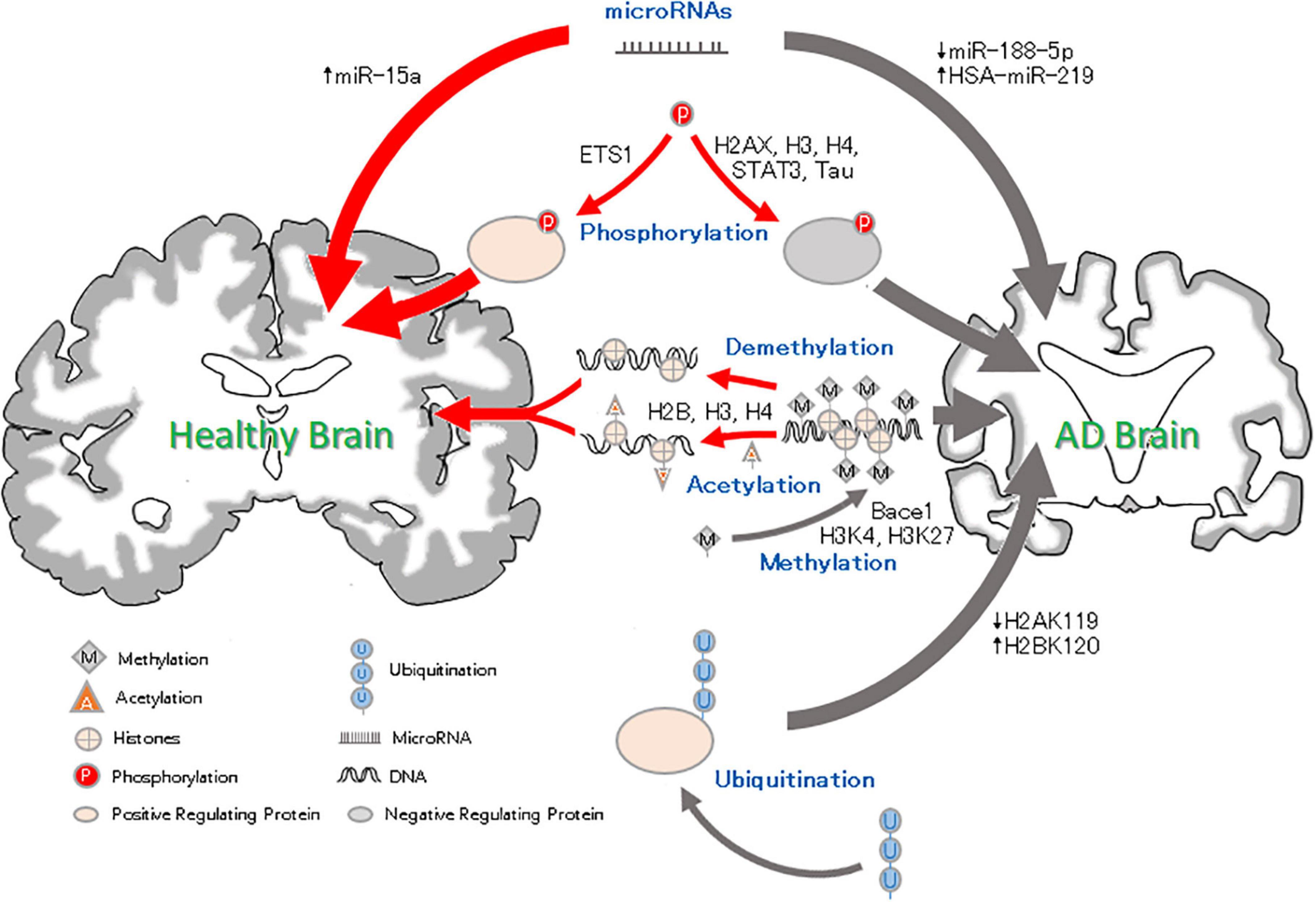 Frontiers  Epigenetics in Alzheimer's Disease