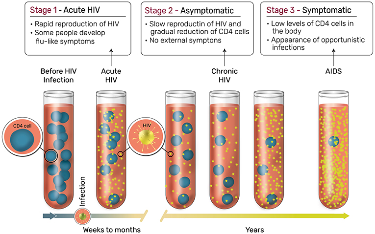 图 3 - HIV 感染的各个阶段。