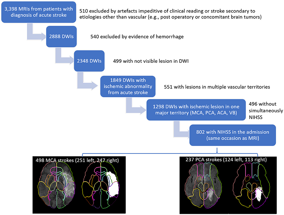 Difference in Strokes When Right-Handed vs Left-Handed