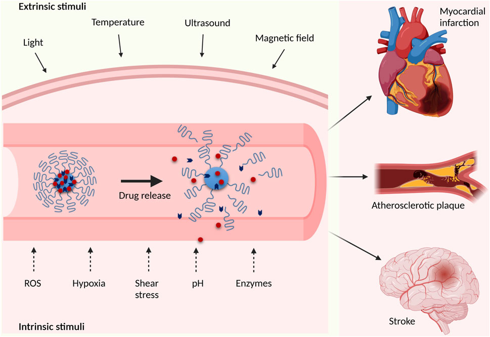 Frontiers On-Demand Drug Recent in Cardiovascular Applications