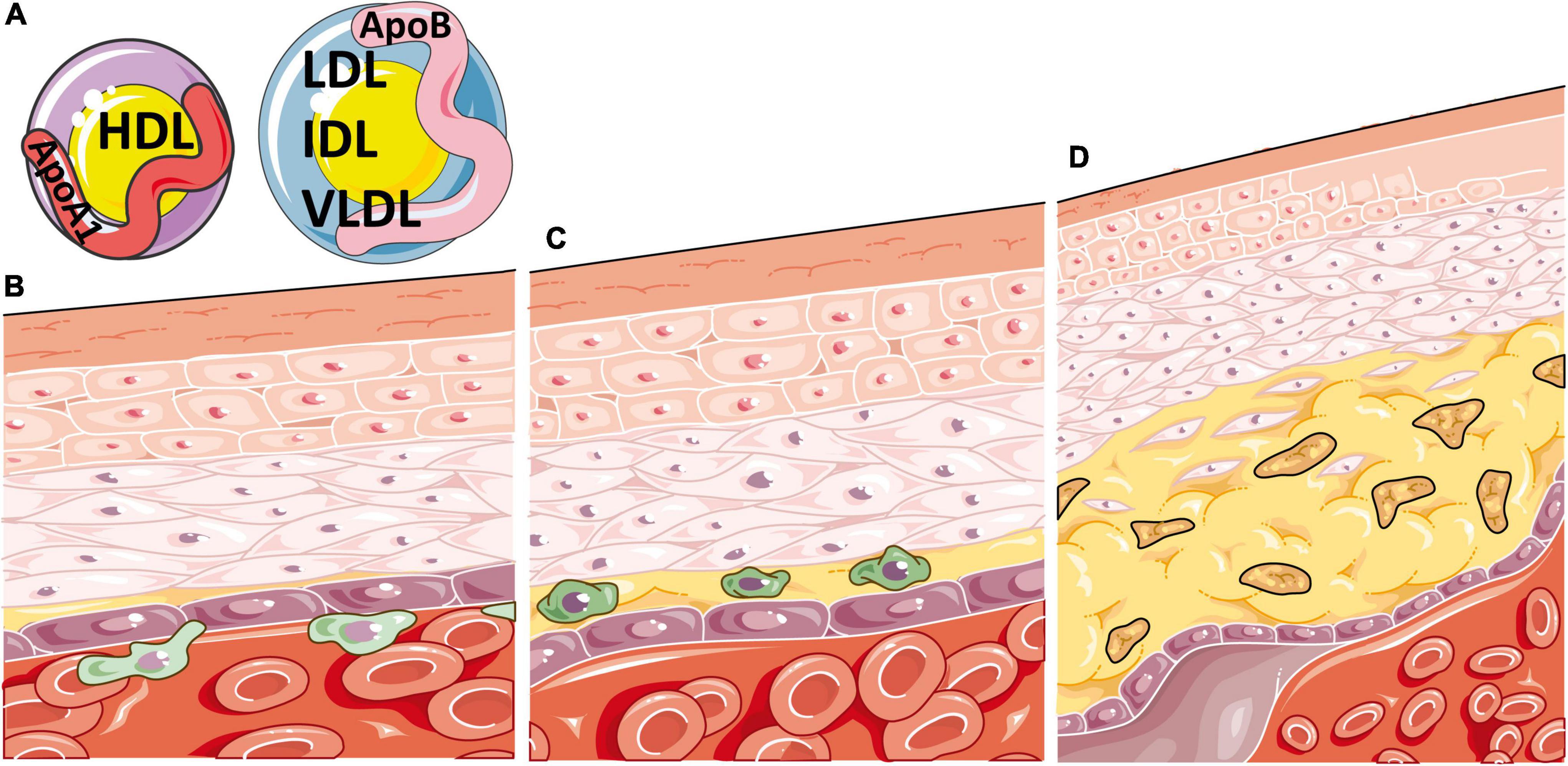 Frontiers | Sex Differences in Lipid Metabolism: Implications for Systemic  Lupus Erythematosus and Cardiovascular Disease Risk