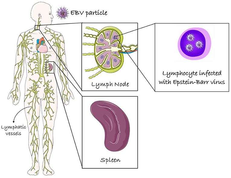 Figure 1 - The lymphatic system and its organs: A lymph node and the spleen.