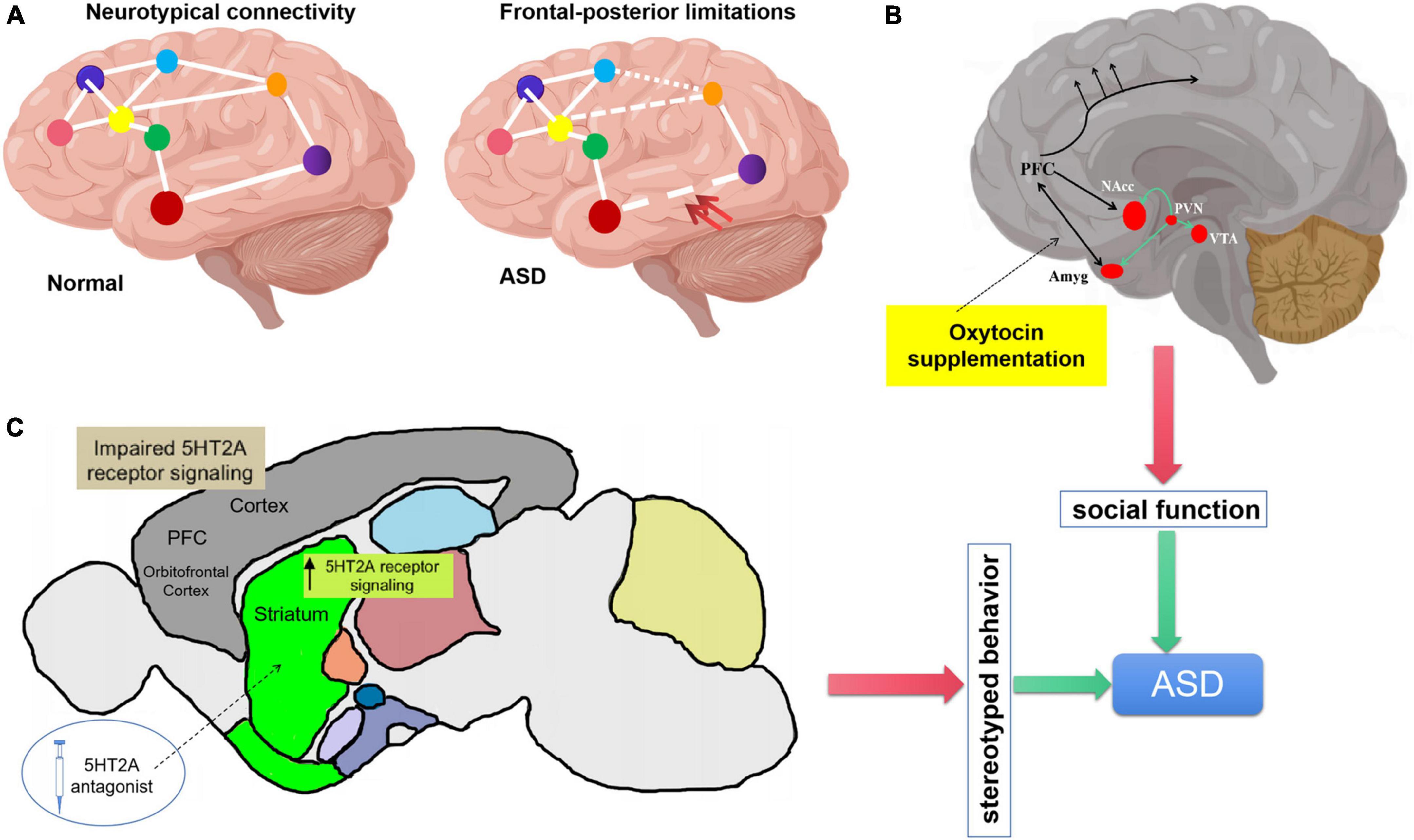 Brain 140