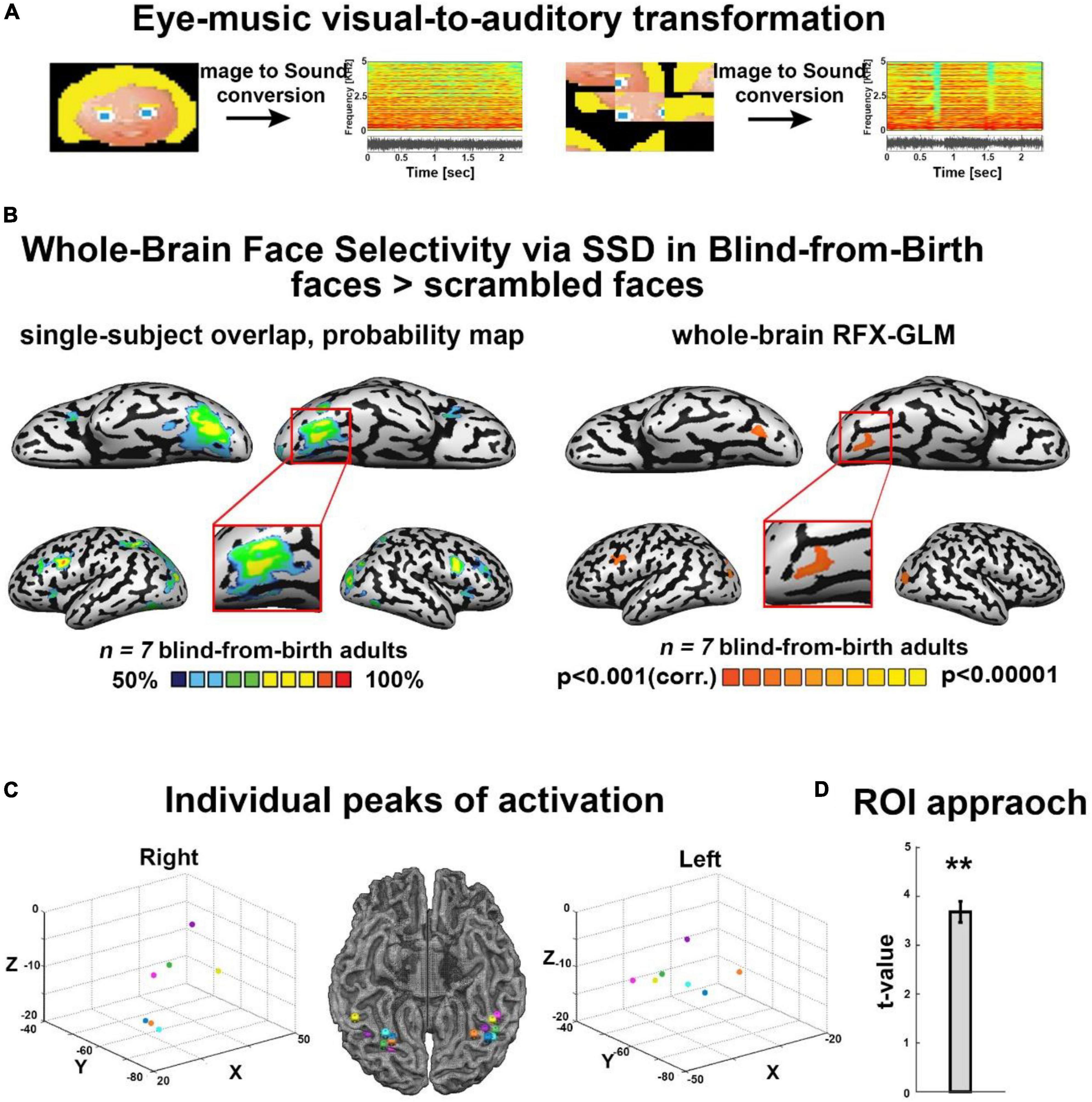Frontiers  Face shape processing via visual-to-auditory sensory  substitution activates regions within the face processing networks in the  absence of visual experience