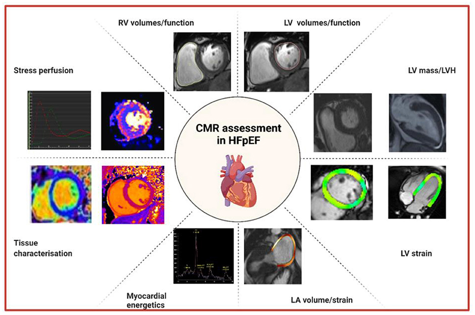 Journal of Magnetic Resonance Imaging: Vol 55, No 1