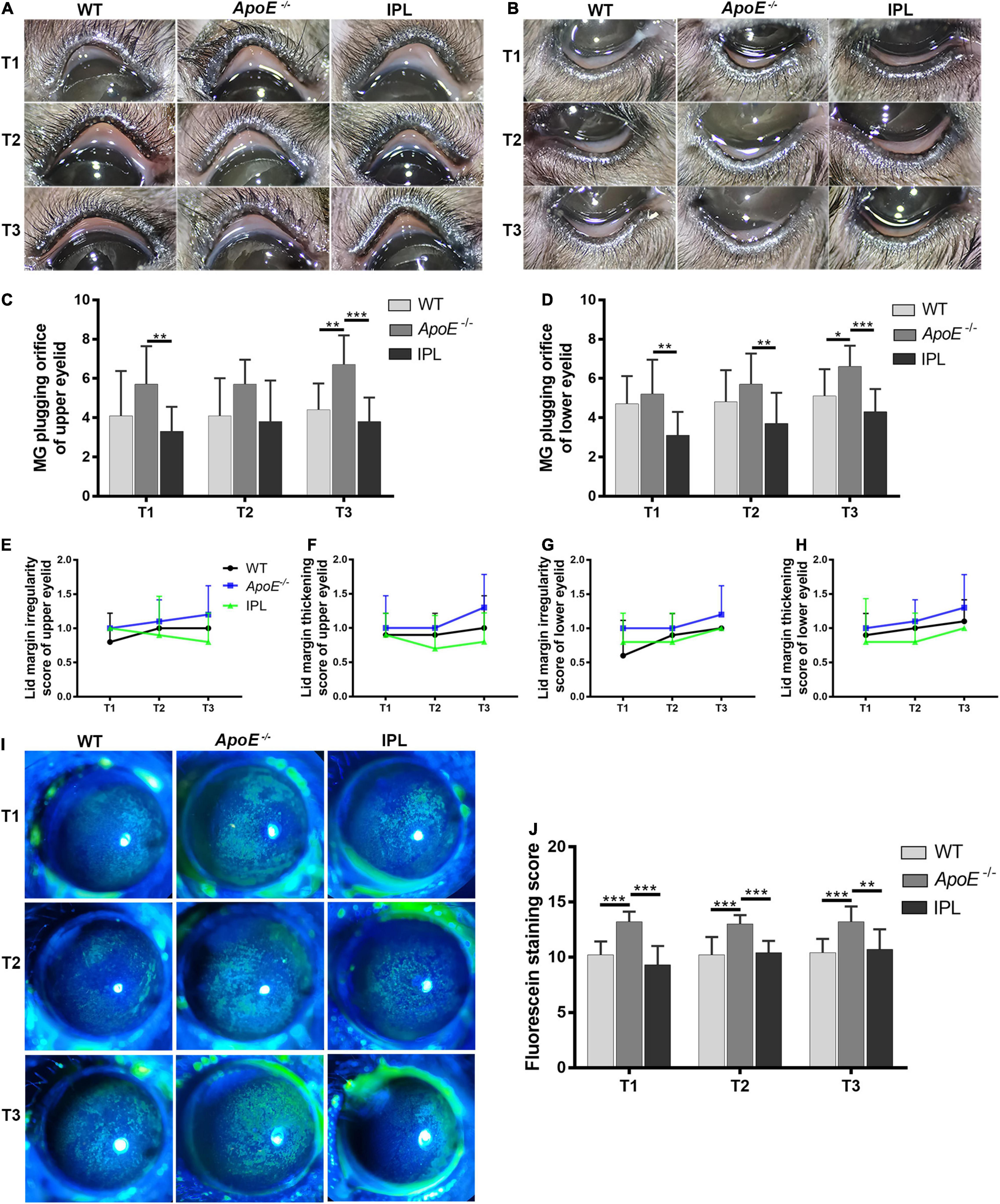 Frontiers Indirect Application of Intense Pulsed Light Induces Therapeutic Effects on Experimental Murine Meibomian Gland Dysfunction image