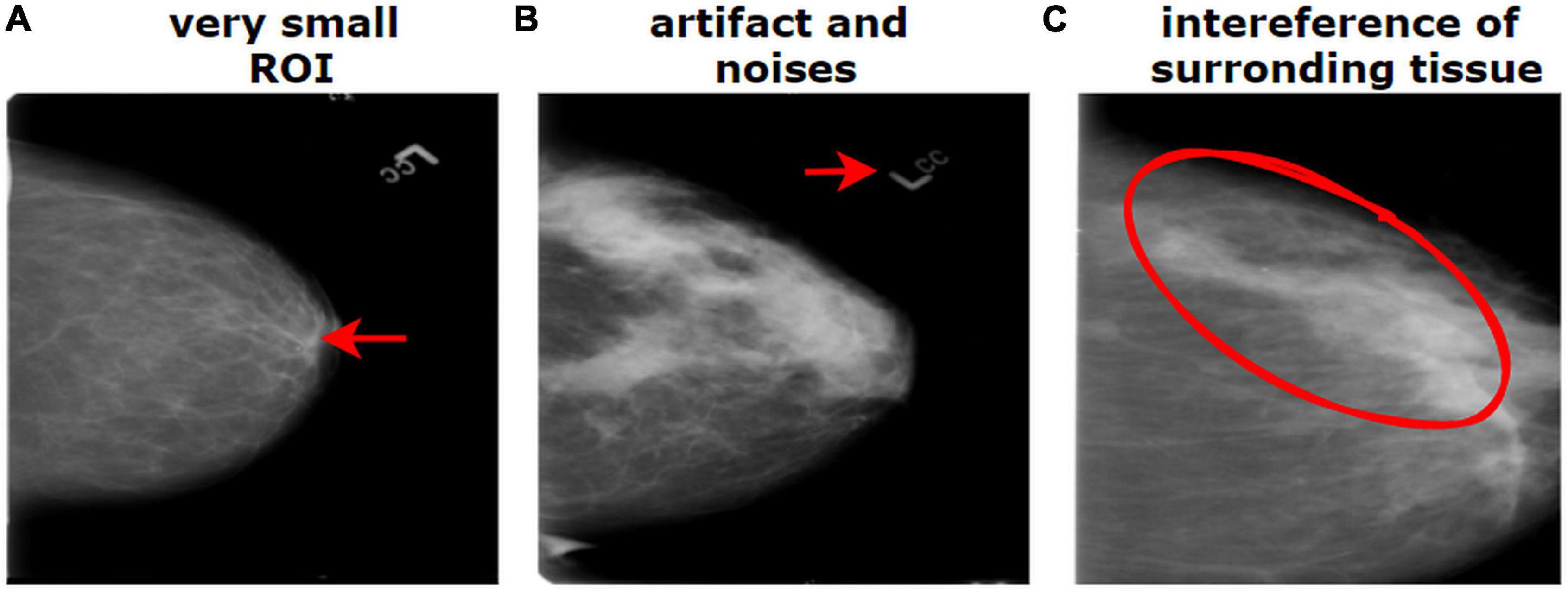 Frontiers  MNet-10: A robust shallow convolutional neural network model  performing ablation study on medical images assessing the effectiveness of  applying optimal data augmentation technique