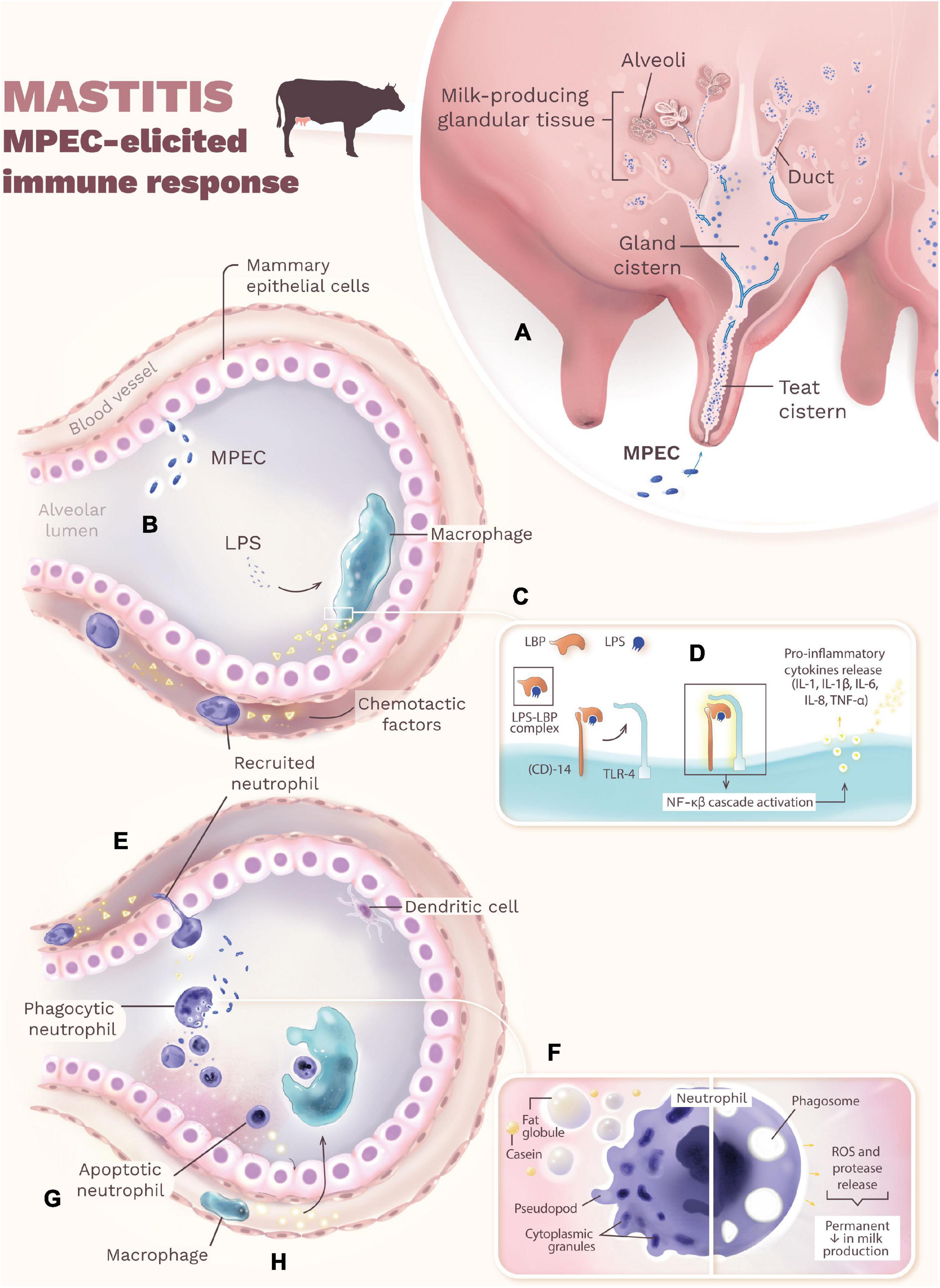 Mastitis: Causes, Symptoms, Treatment & Prevention