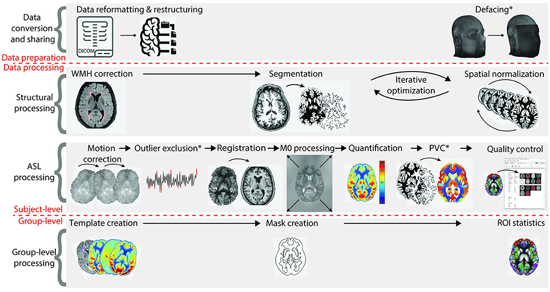Frontiers A Beginner's Guide to Arterial Spin Labeling (ASL) Image