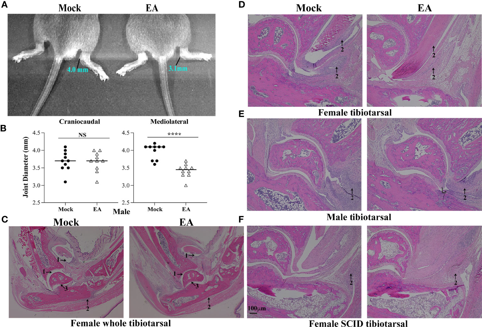 Frontiers  Sciatic–Vagal Nerve Stimulation by Electroacupuncture  Alleviates Inflammatory Arthritis in Lyme Disease-Susceptible C3H Mice