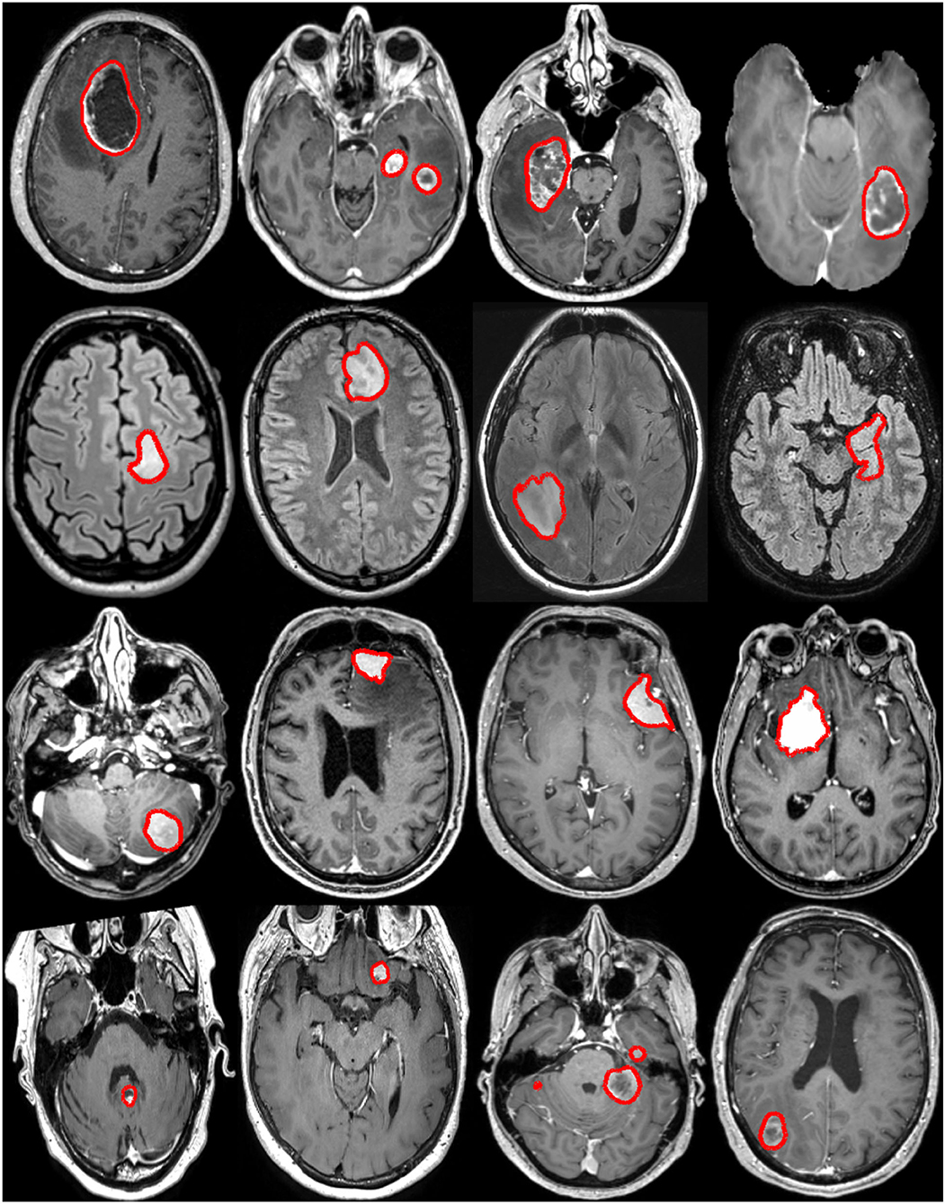 The test database of MR brain images and corresponding results for the