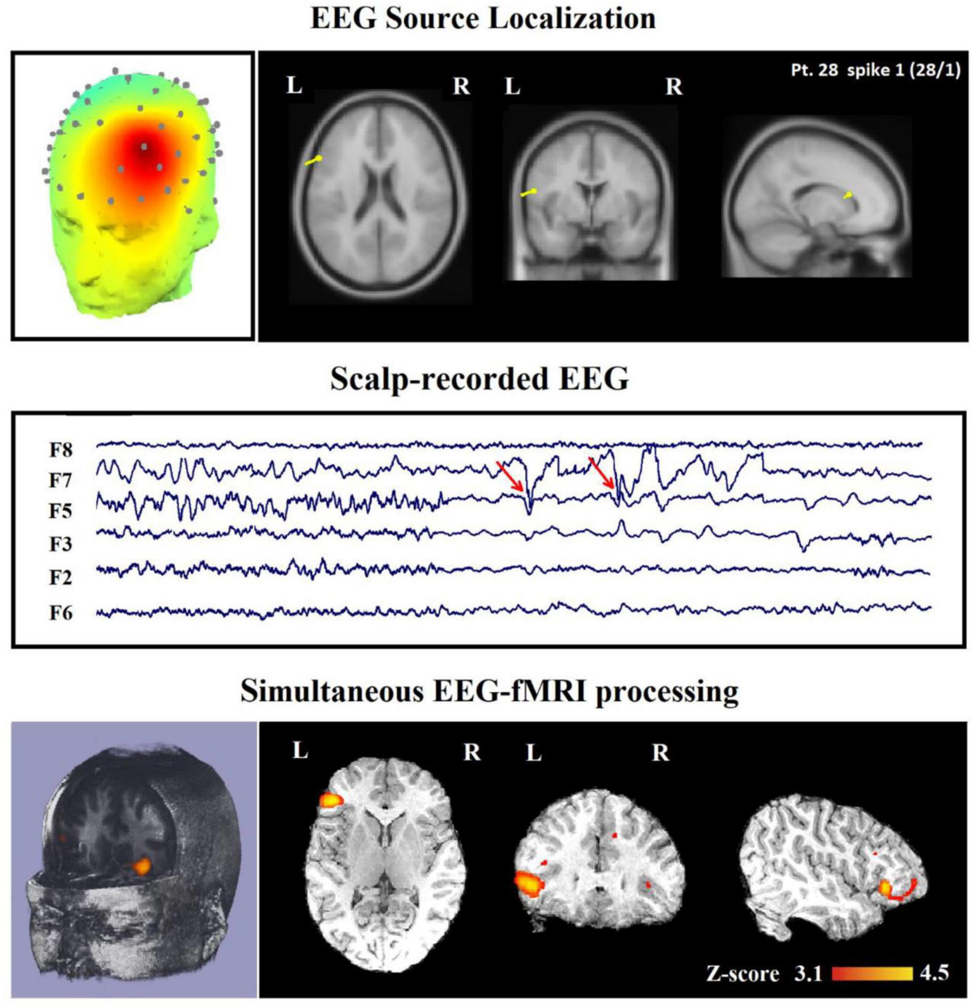 Large-scale functional brain networks in human non-rapid eye movement  sleep: insights from combined electroencephalographic/functional magnetic  resonance imaging studies