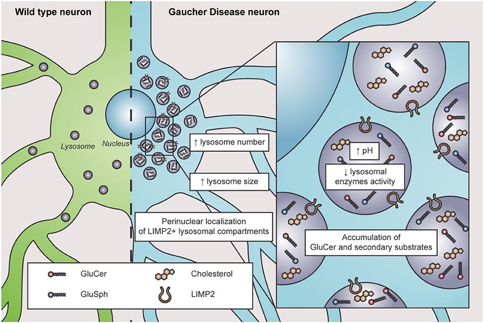 Niemann-Pick disease type C. The diagram represents subtypes and