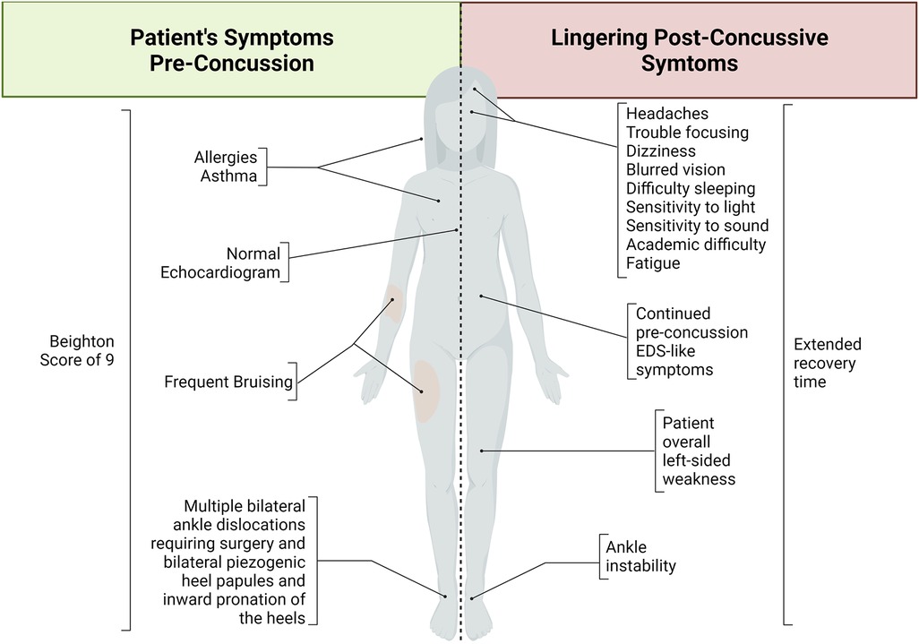 Frontiers | Case report: Lingering post-concussive symptoms in a ...