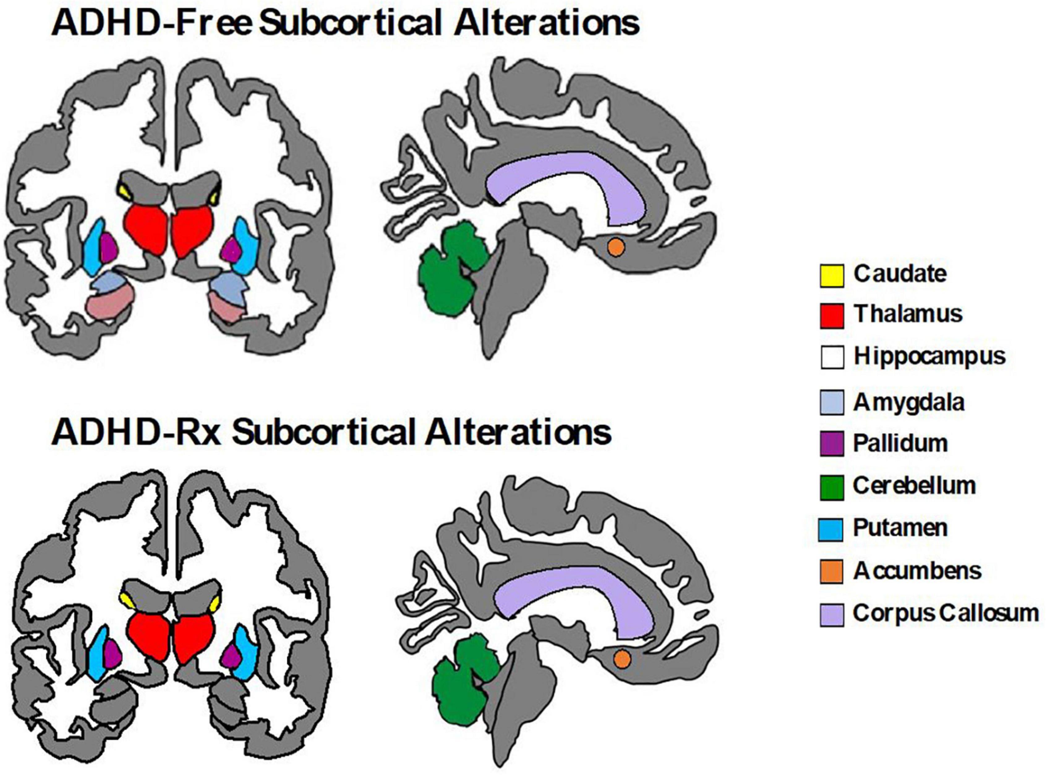 ADHD Masquerading as Cautopyreiophagia Exacerbated by Risperidone and  Improved With Methylphenidate in a Preschooler