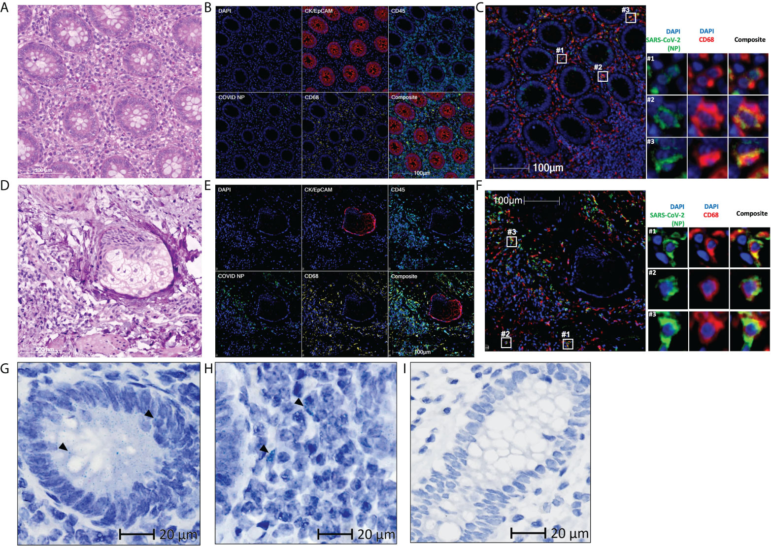 Getting Started with RNAscope™ Image Analysis in HALO® - Indica Labs