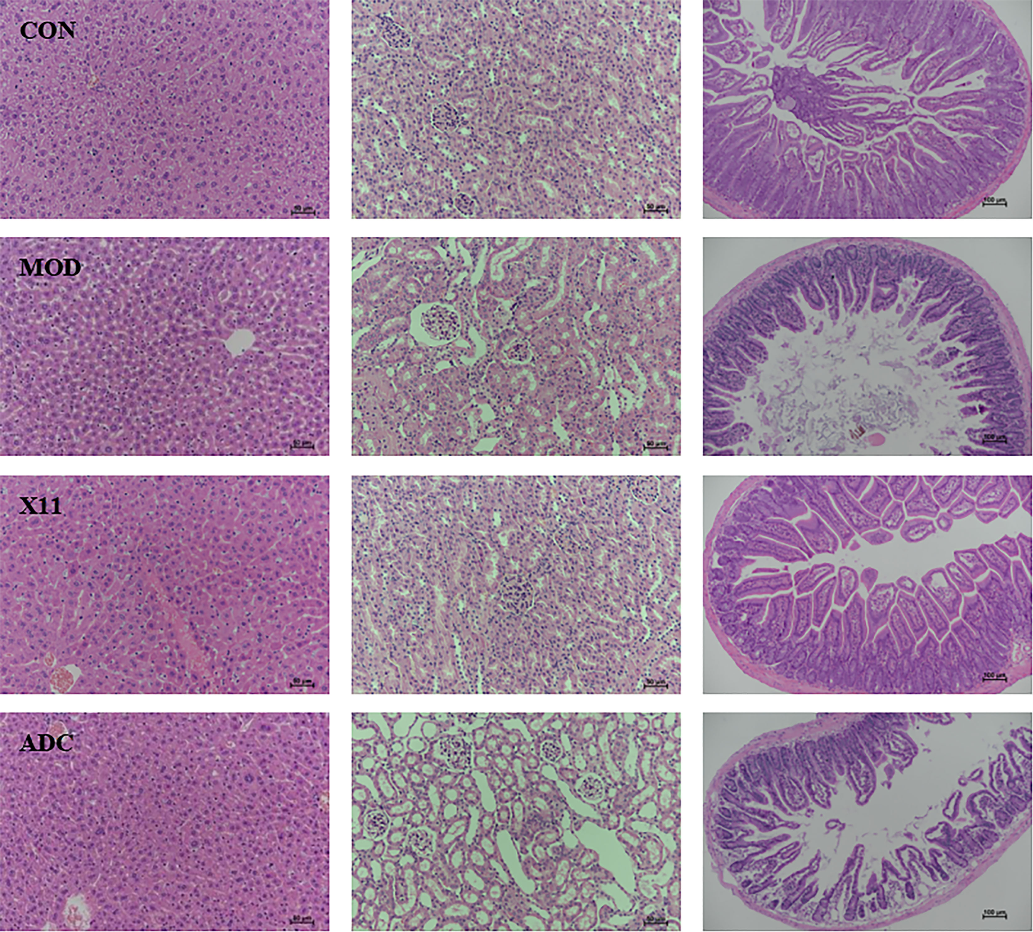 Lactobacillus Paracasei