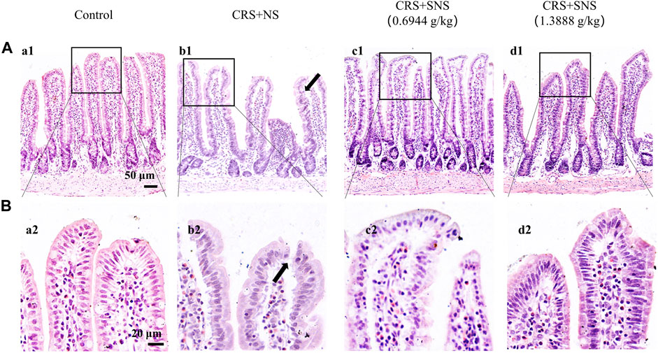 【18％OFF】 stress-induced  chronic on Si-Ni-San of mechanism and effect Ameliorative | Frontiers diarrhea-irritable rats in syndrome bowel レコーダー