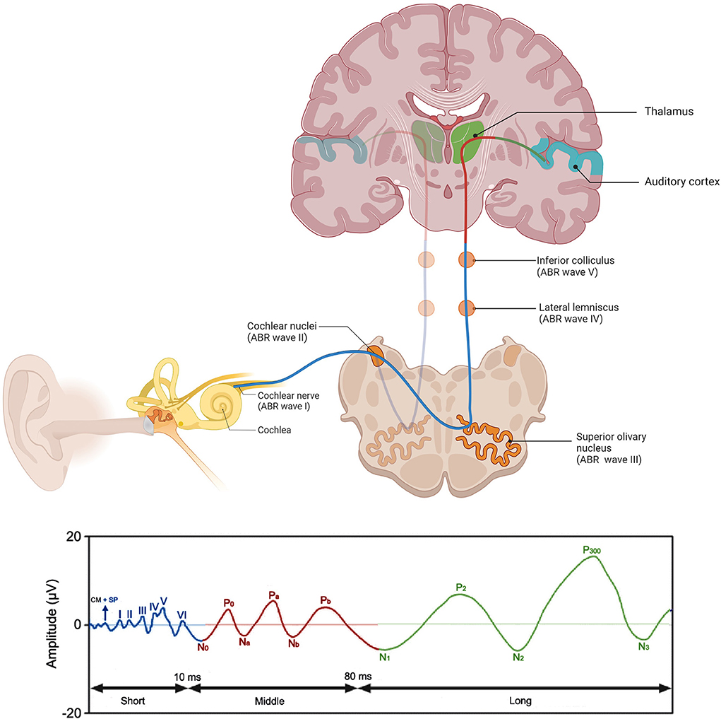 Automated cortical auditory evoked potentials threshold estimation in  neonates - ScienceDirect