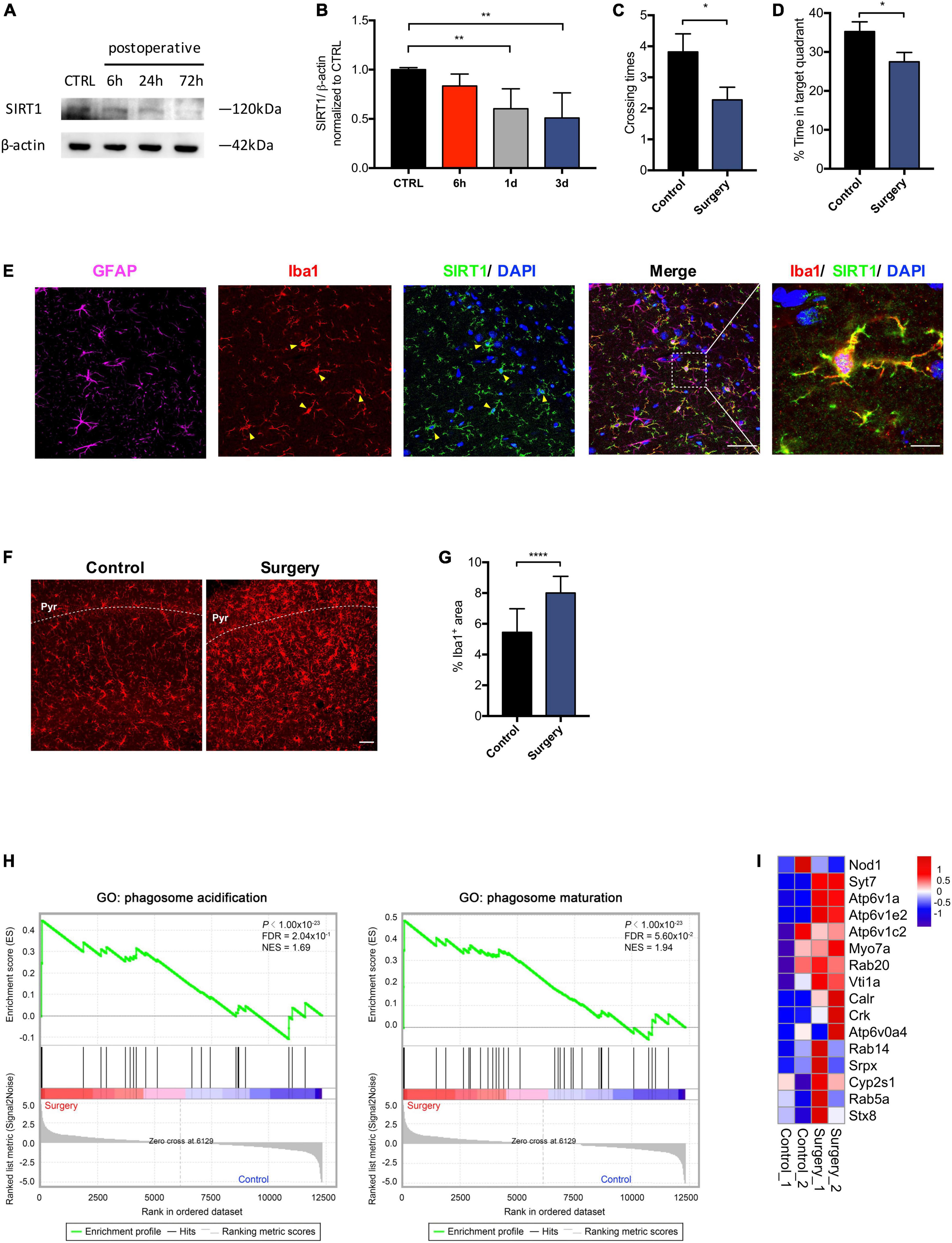 Frontiers | SIRT1 activation attenuates microglia-mediated