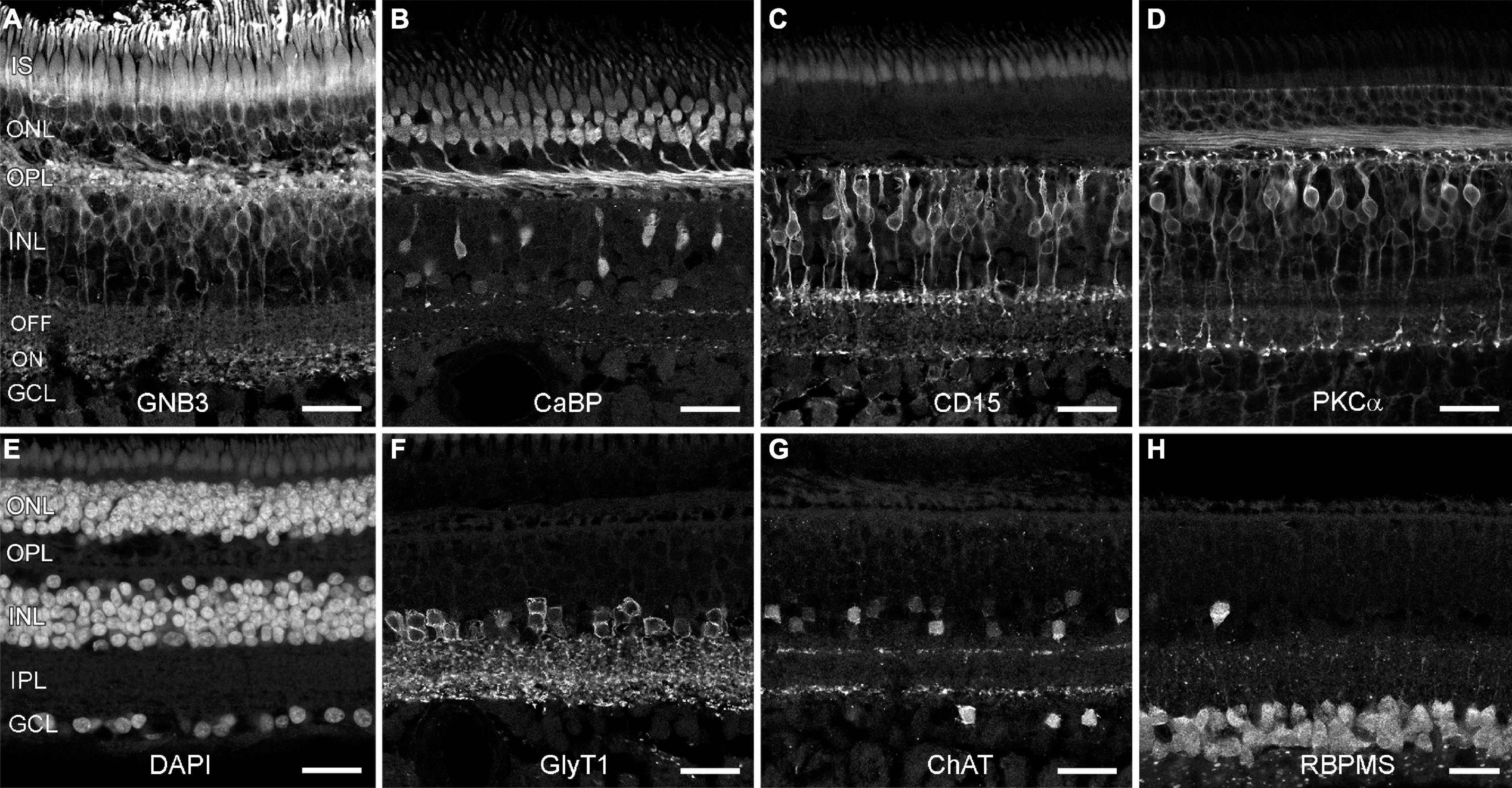 Frontiers | No evidence for age-related alterations in the marmoset retina