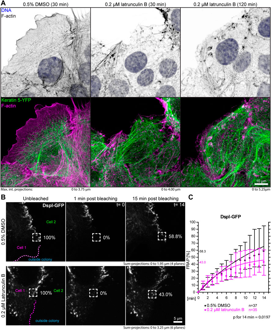 Nanostructure of the desmosomal plaque