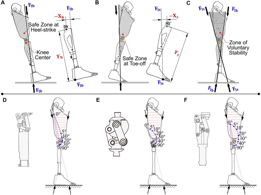 72 Above Knee Amputee Images, Stock Photos, 3D objects, & Vectors