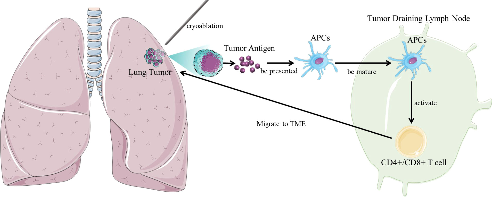 Lung Neoplasms 