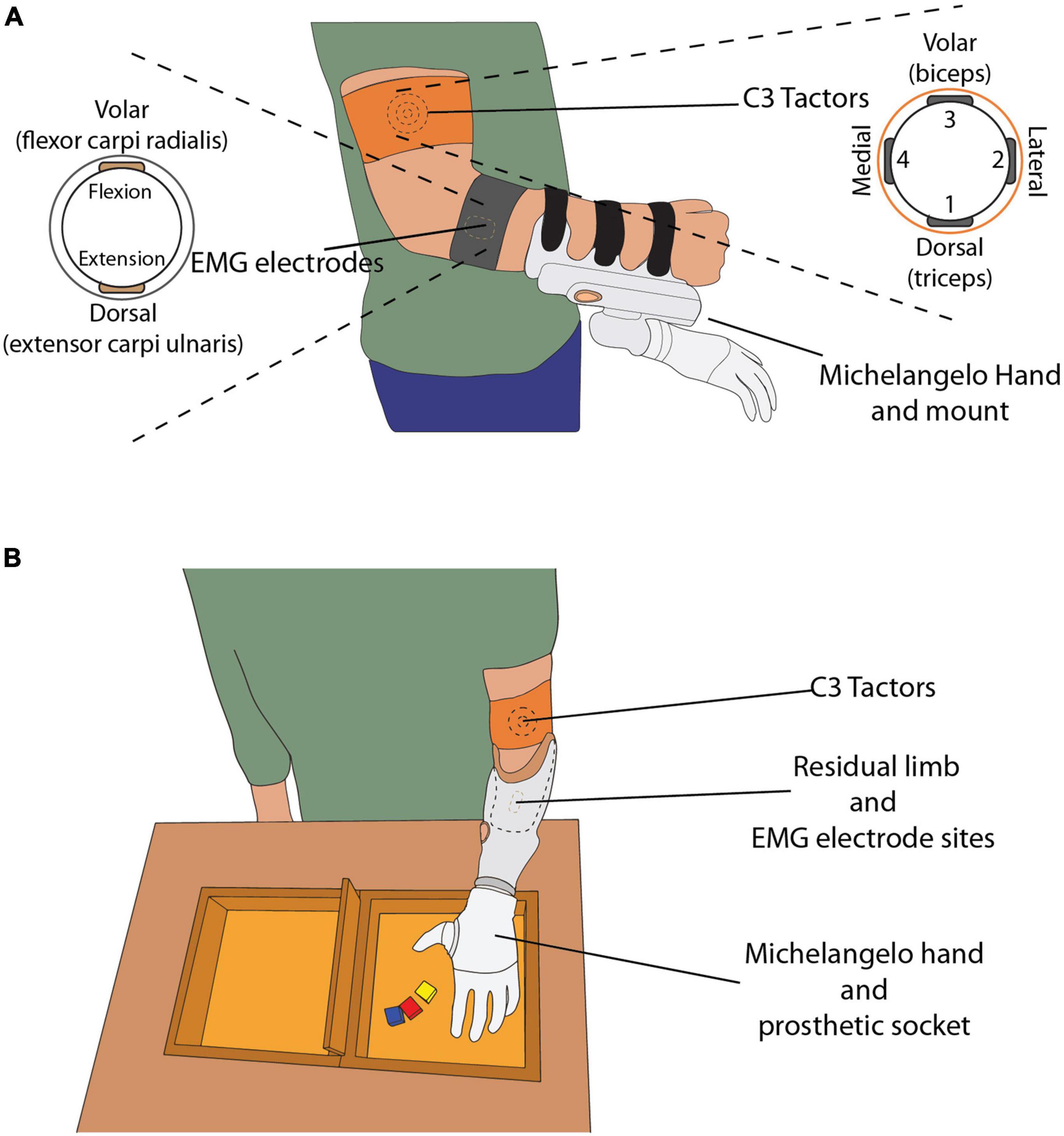 Electromyographic evaluation of upper limb muscles involved in armwrestling  sport simulation during dynamic and static conditions - ScienceDirect