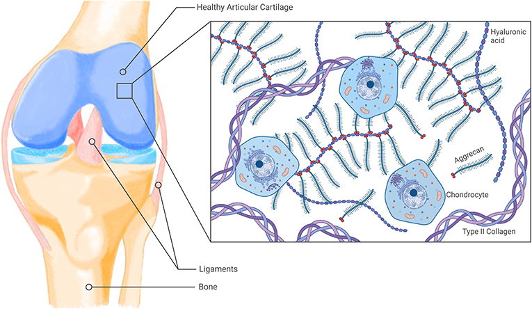 Figure 1 - Articular cartilage is the tissue that makes up joints like the knee, and it cushions the bones.