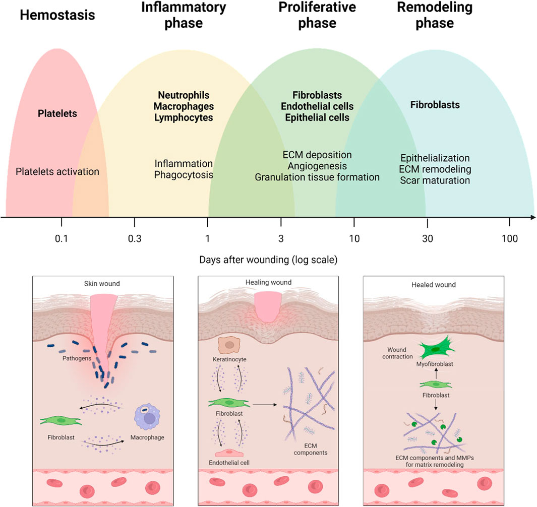 Frontiers  Exploring the contribution of pro-inflammatory cytokines to  impaired wound healing in diabetes