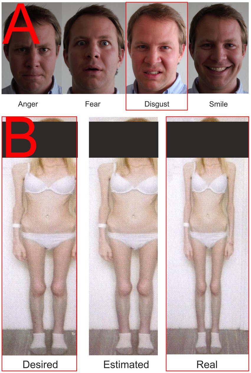 Frontiers The sight of ones own body Could qEEG help predict the treatment response in anorexia nervosa?