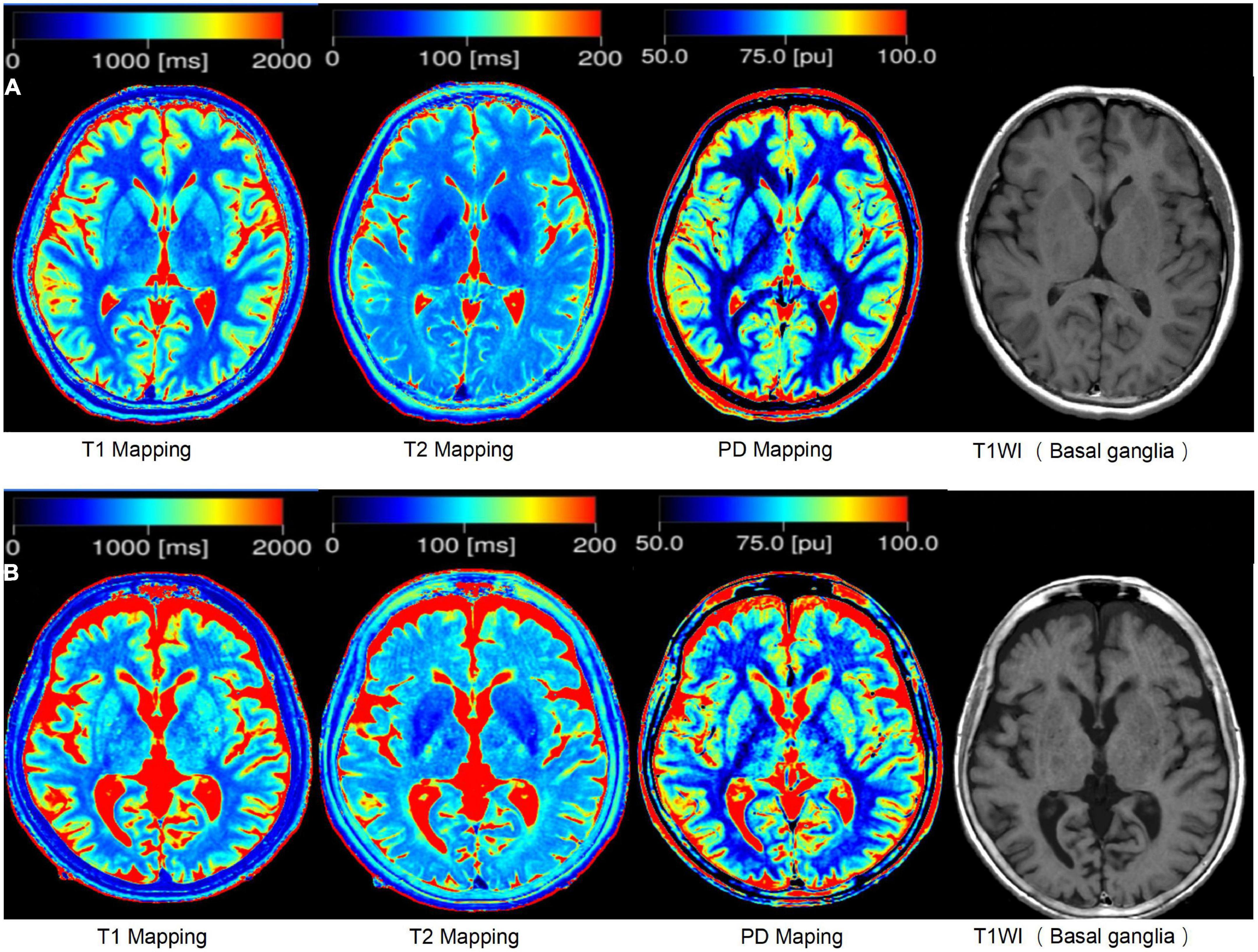 Dedicated 3D ABUS images in healthy volunteers: (a) male volunteer, (b)