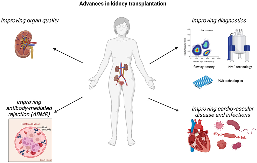 kidney transplant research articles